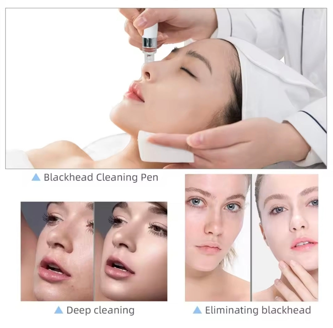 7-in-1 Hydro Bubble Facial Machine – Oxygen Jet | Diamond Peeling | Microdermabrasion | Deep Hydration & Cleansing for Professional Spa & Home Use